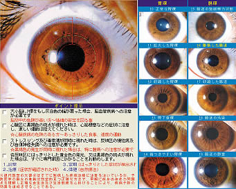 虹彩について - デッドシースパ日本初の老舗サロン - kibbnet(キブネット)