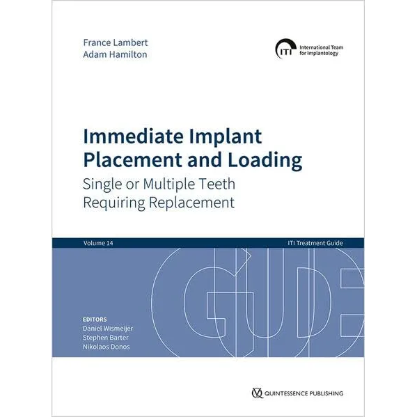 ITI Treatment Guide Vol.14:Immediate Implant Placement and Loading