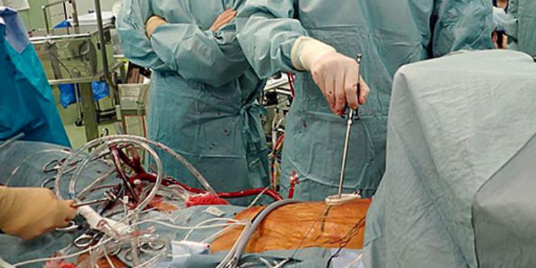 低侵襲心臓手術：MICS | 医療法人 澄心会 豊橋ハートセンター