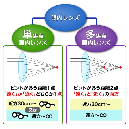 多焦点眼内レンズ（遠近両用） 白内障の専門医 大分県別府市 みなと