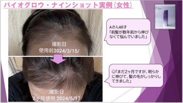 ✨次世代コスメ！再生医療現場から育毛発毛業界へ/頭皮に革命を起こす