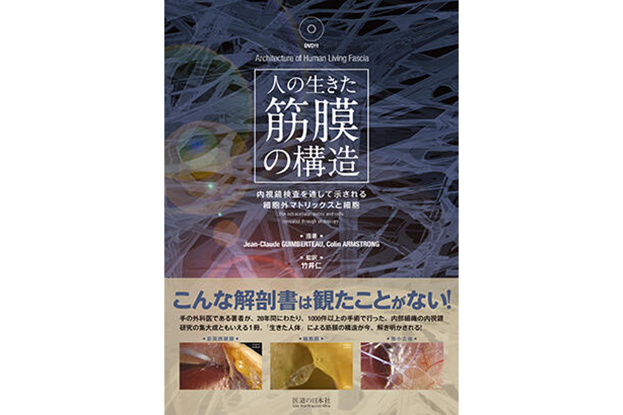 人の生きた筋膜の構造 内視鏡検査を通して示される細胞外マトリックス