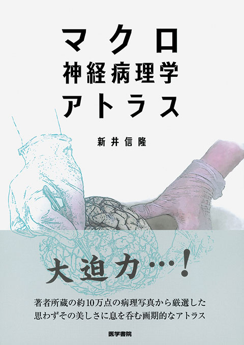 末梢神経病理 | 書籍詳細 | 書籍 | 医学書院