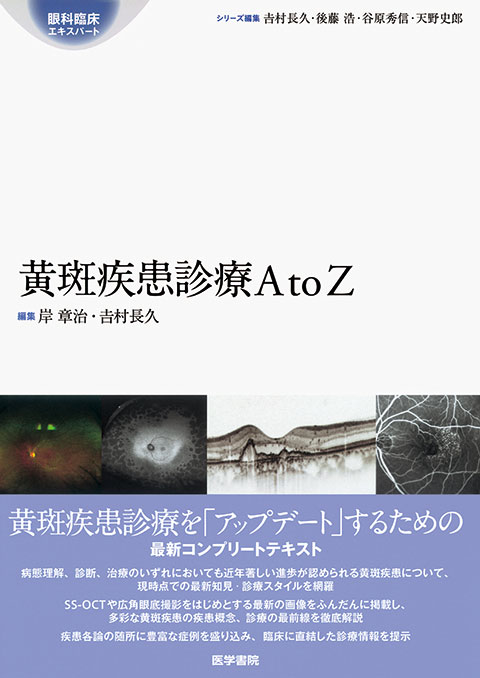 加齢黄斑変性 第2版 | 書籍詳細 | 書籍 | 医学書院