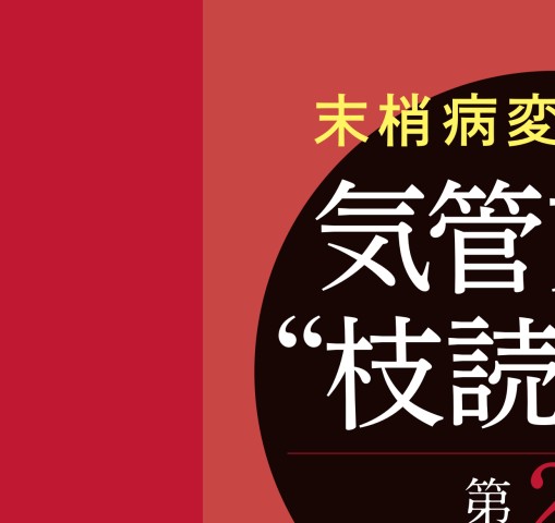 末梢病変を捉える 気管支鏡“枝読み”術 [DVD-ROM（Windows版）付] 第2版