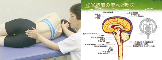 頭蓋・仙骨部機能異常編1 筋膜リリース「治療編」～その理論から治療