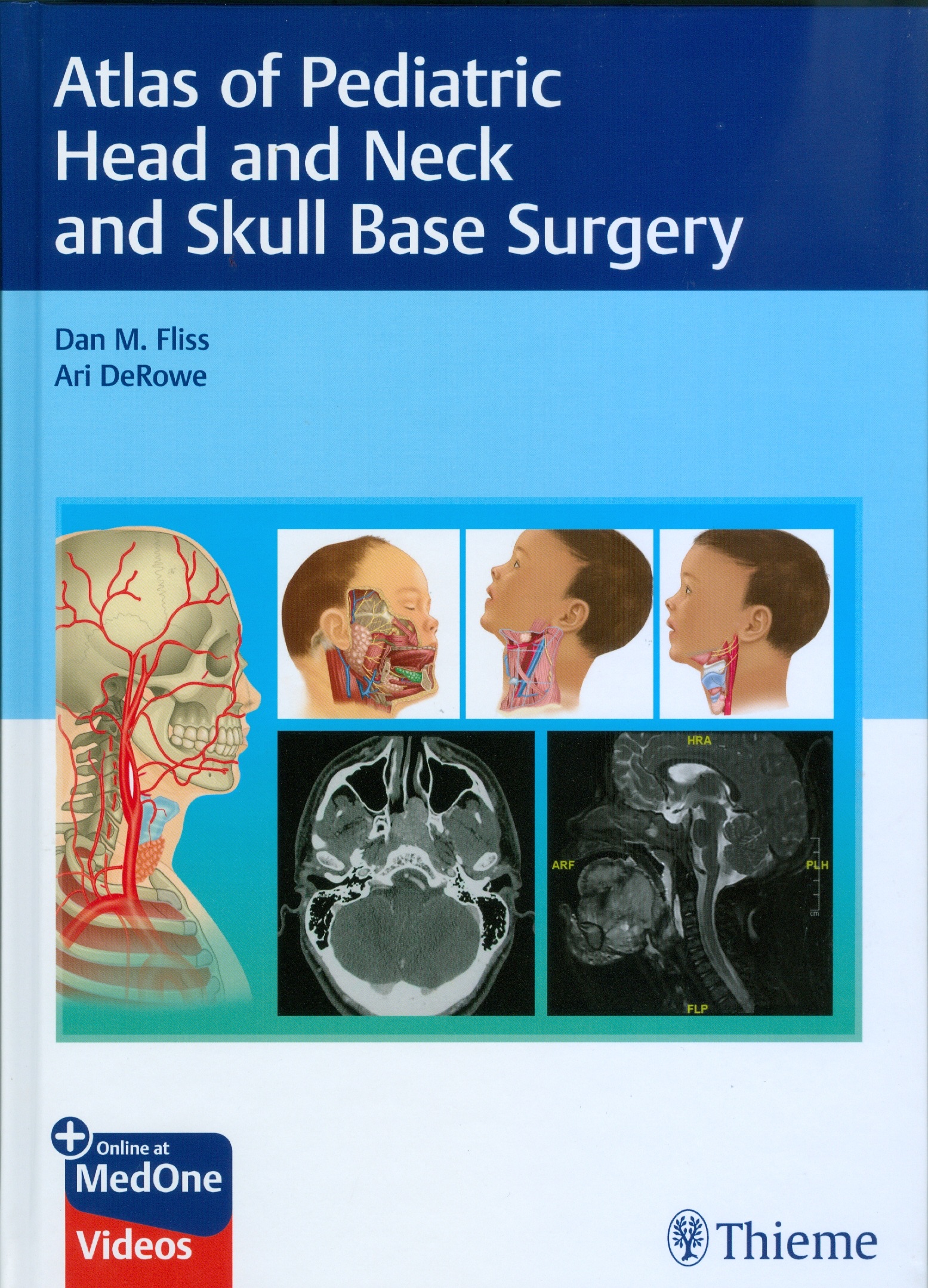 Atlas of Pediatric Head and Neck and Skull Base Surgery - The