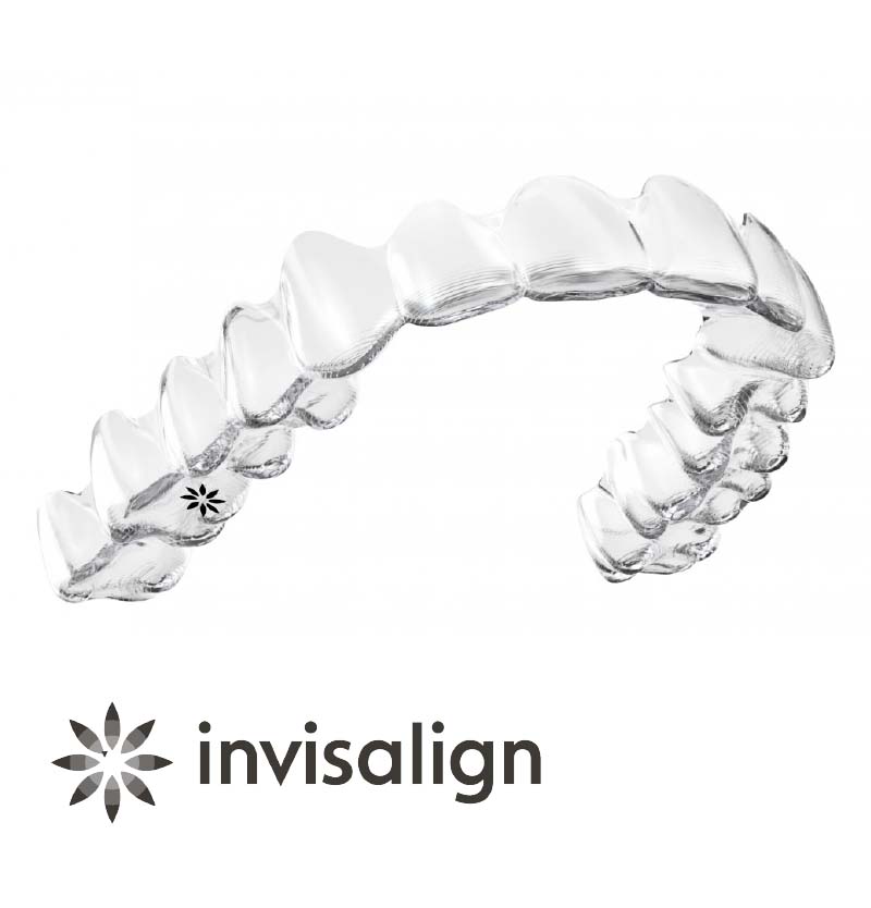 アライナー型（インビザライン）矯正装置の治療について | 神保矯正歯科