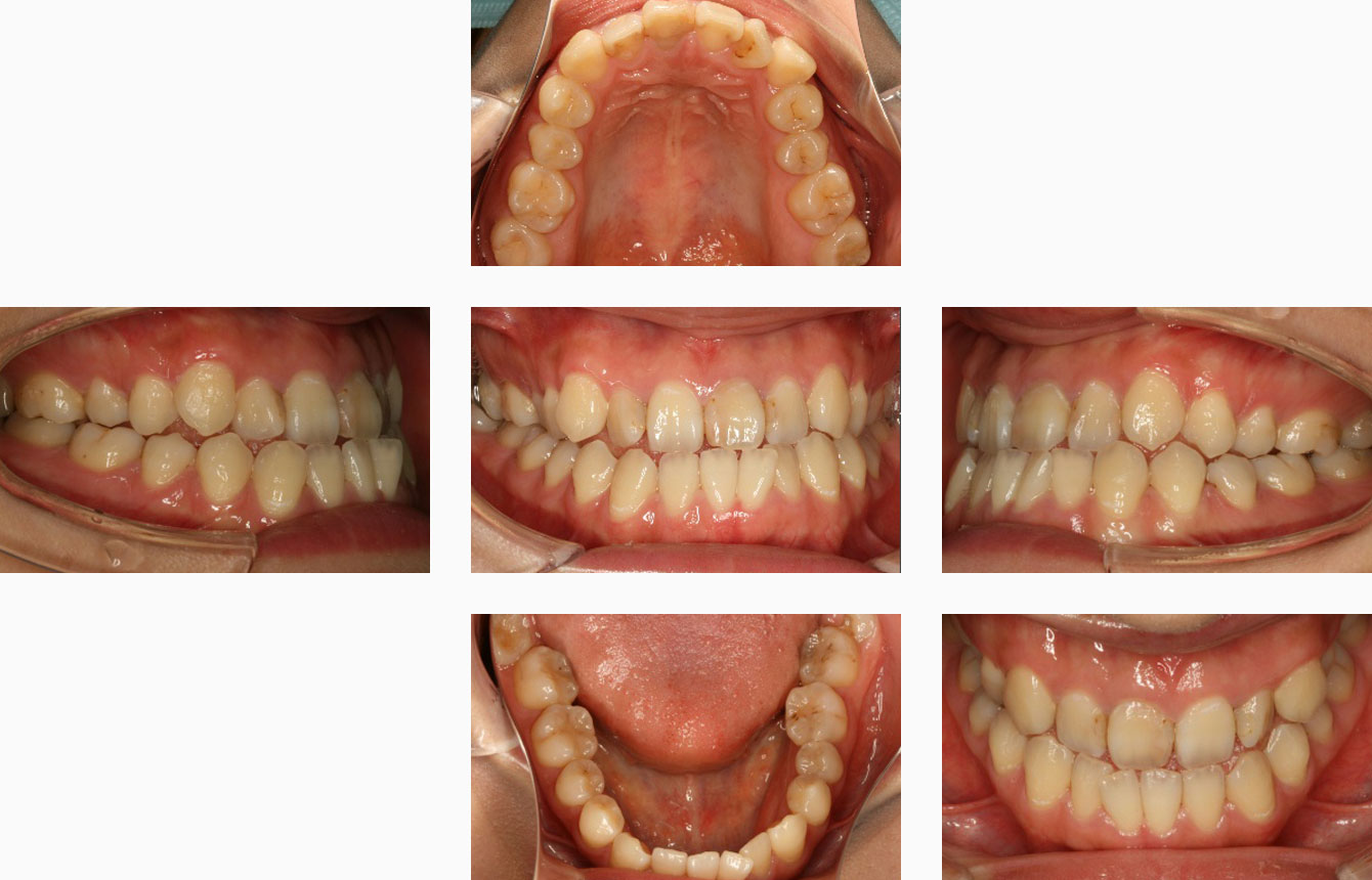 vol.33 「顎矯正手術を併用する矯正歯科治療」の実際：トレンド