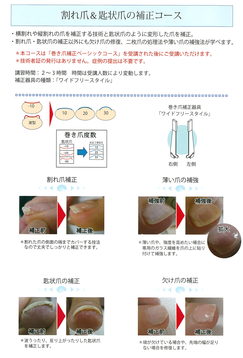 ペディグラス ニューパワーフリースタイル R10個 ペディグラス ニュー