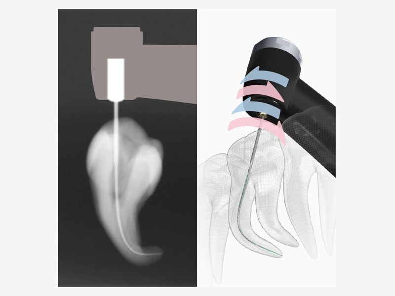 Tri Auto ZX2 | MORITA