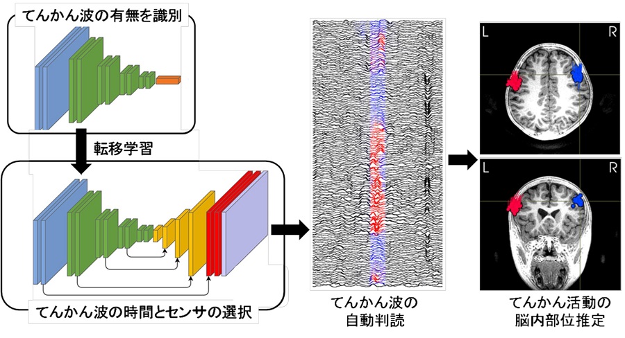 平野 諒司、平田 雅之 ≪脳機能診断再建学≫ 人工知能によりてんかん