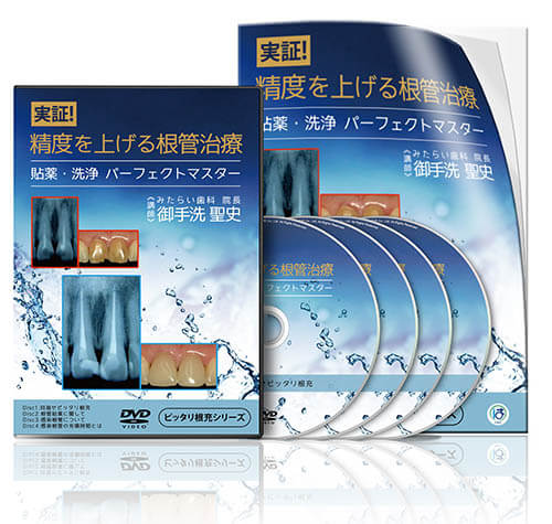 実証！精度を上げる根管治療 〜貼薬・洗浄 パーフェクトマスター