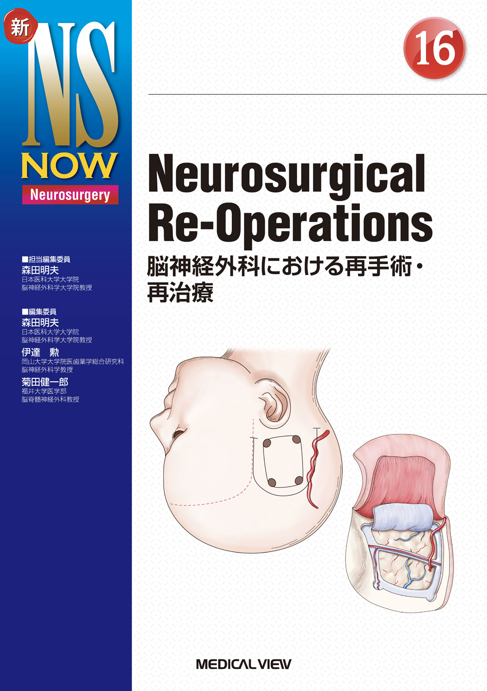 メジカルビュー社｜脳神経外科｜新NS NOW 16 Neurosurgical Re-Operations