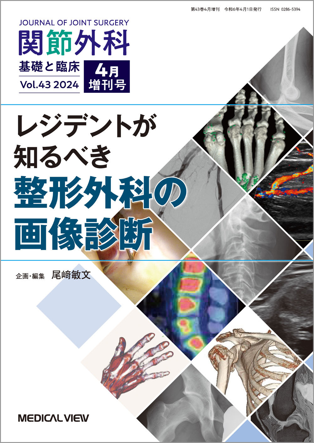 メジカルビュー社｜関節外科特集一覧｜関節外科 2024年4月増刊号