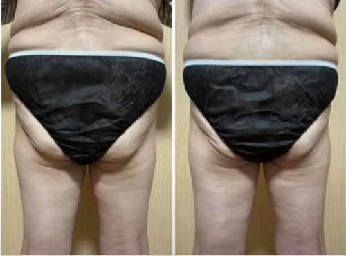 マッコイ | ノンFシェイプEX 250g