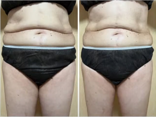 マッコイ | ノンFシェイプEX 250g