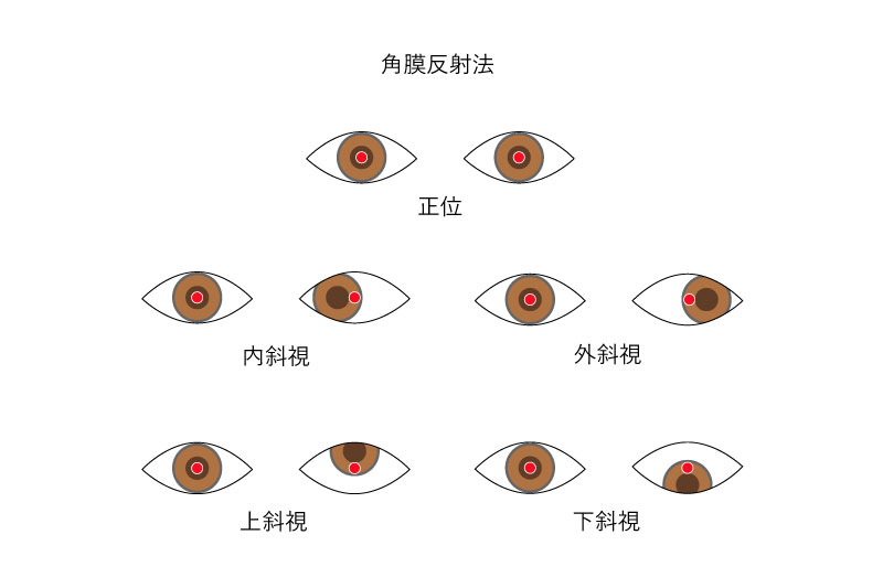 眼位検査｜検査方法を知る - Myopia Square（マイオピア スクエア）