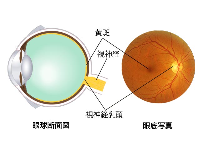 眼底検査｜検査方法を知る - Myopia Square（マイオピア スクエア）