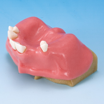 サイナスリフト実習用顎模型 [P9-X.1142]｜株式会社ニッシン｜歯科模型