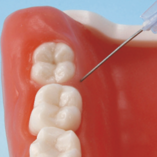 口腔外科実習用顎模型 [P15FE-OOP.1](FE咬合器つき)｜株式会社ニッシン