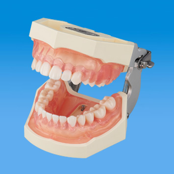 SRP実習用顎模型 [P15FE-500HPRO-S2B1-GSE]｜株式会社ニッシン｜歯科