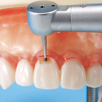 保存修復実習用顎模型 [D16FE-500E(GSE)](FE咬合器つき)｜株式会社