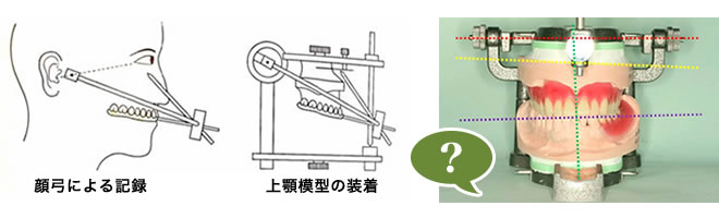 シーラシステムとは | 大手町 歯科｜大手町駅直結の歯医者 松翁会歯科