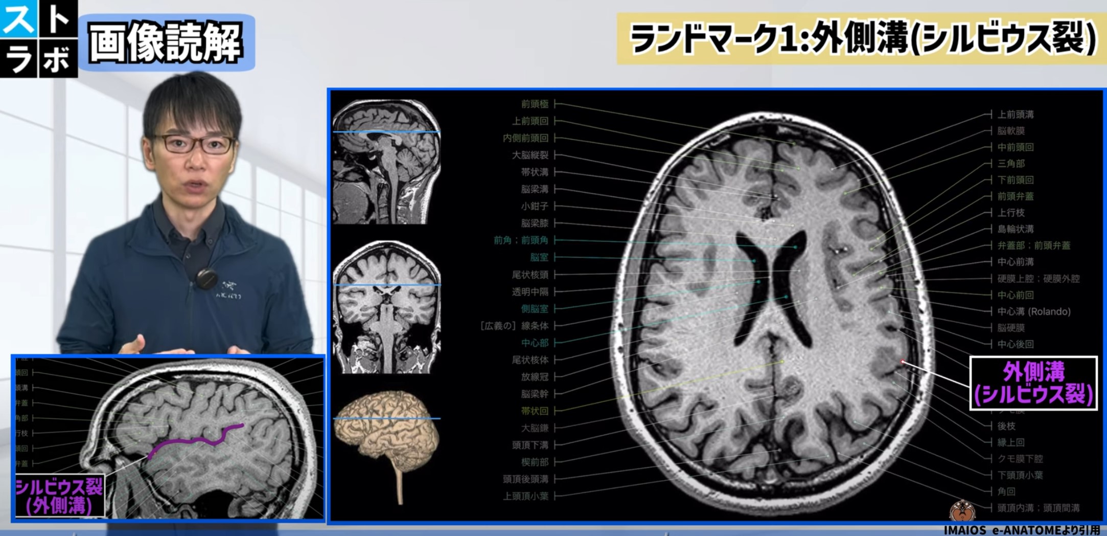 2024年版】下側頭回の機能とリハビリテーション：視覚認知と記憶の回復