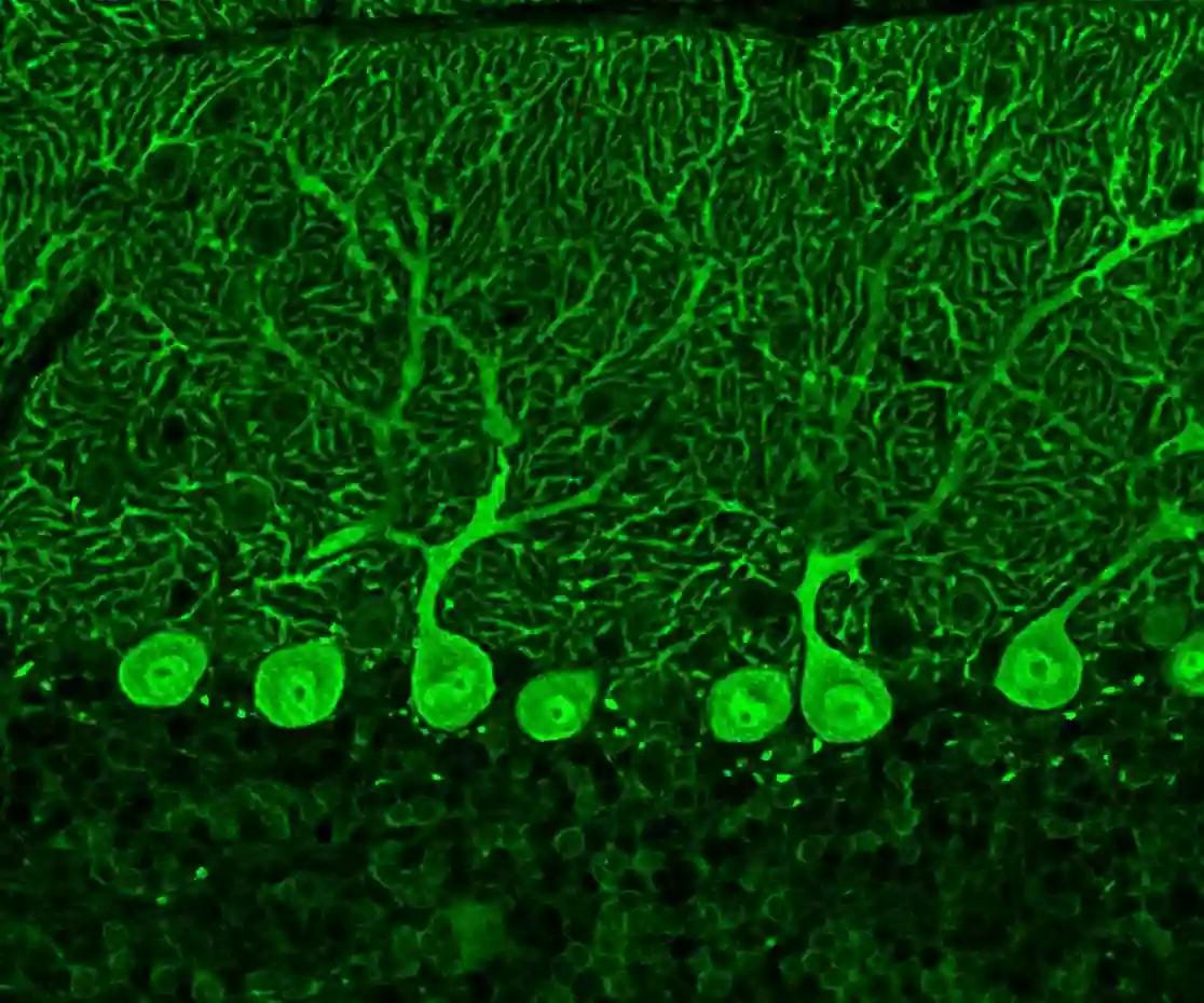 A Guide to Immunostaining the Cerebellum | Proteintech Group