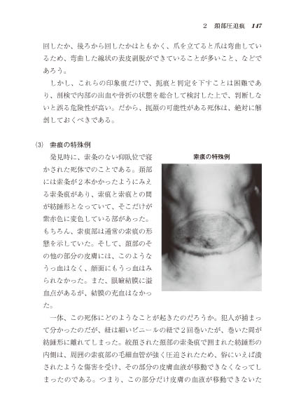 警察・司法／死体の視かた】東京法令出版