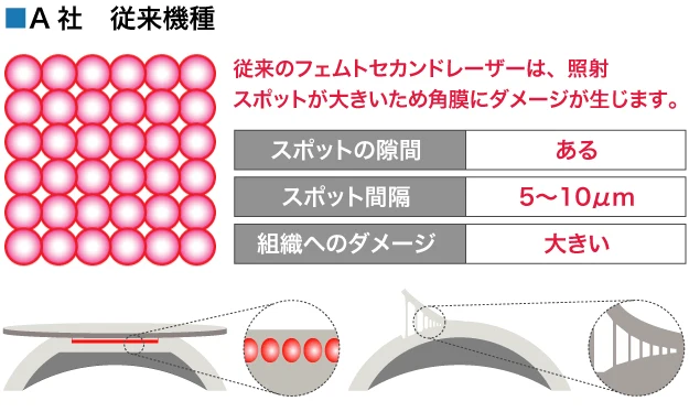 角膜強化型レーシックで視力回復 | 冨田実アイクリニック銀座