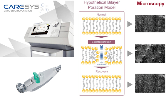 エレクトロポレーション｜ 愛知県岡崎市/名古屋-竜美ヶ丘スキンクリニック-