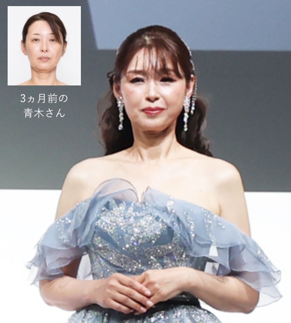 第32回たかの友梨エステティックシンデレラ大会2026 美変身コロシアム