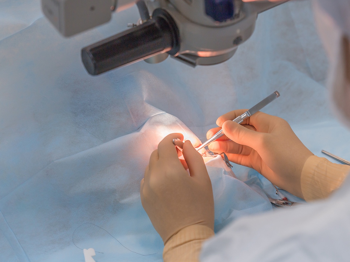 インプラント周囲炎の初期症状から原因・治療・予防まで徹底解説