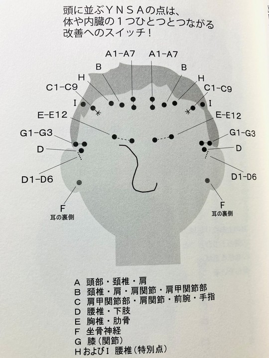 YNSA（山元式新頭鍼療法）について - 静岡駅南口より徒歩3分！静岡