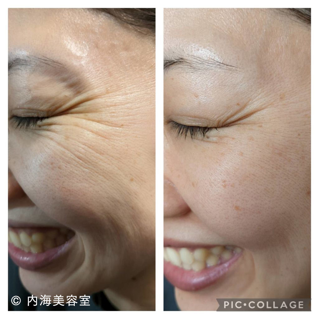 テラステムがおすすめ♪メイク講師もびっくりした使い心地！ | 内海