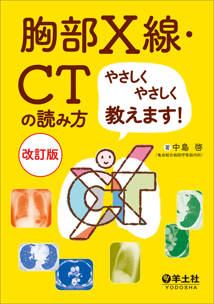 胸部X線・CTの読み方やさしくやさしく教えます！改訂版 - 羊土社