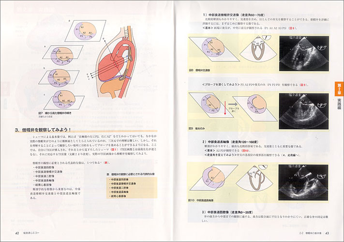 カラー写真で一目でわかる 経食道心エコー〜撮り方，診かたの基本と