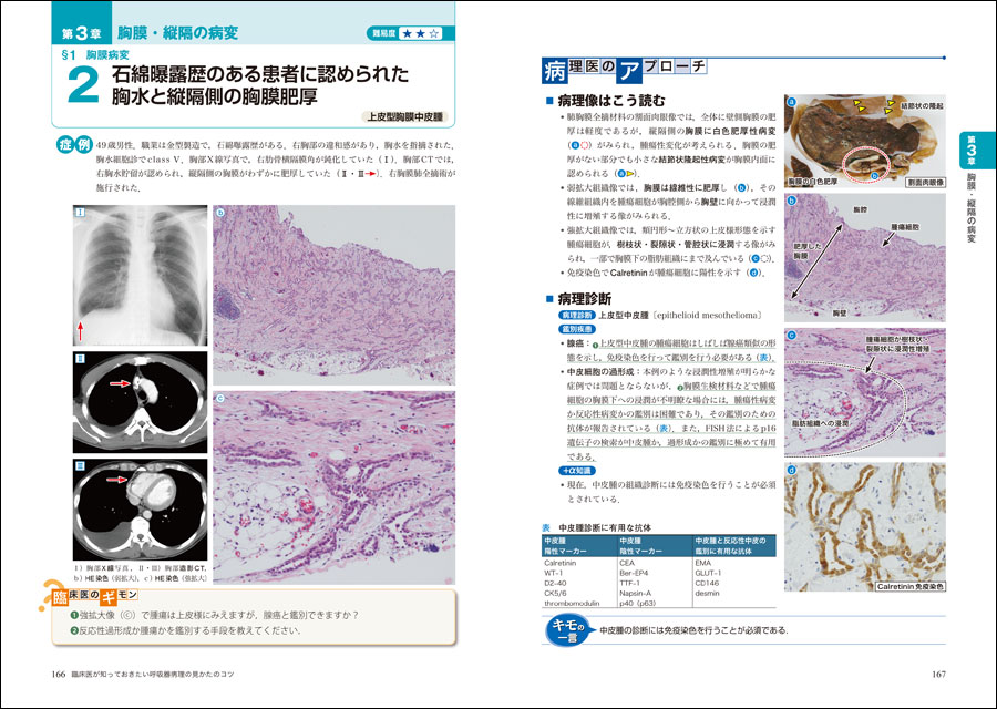 病理像＋X線・CTで一目でわかる！ 臨床医が知っておきたい呼吸器病理の