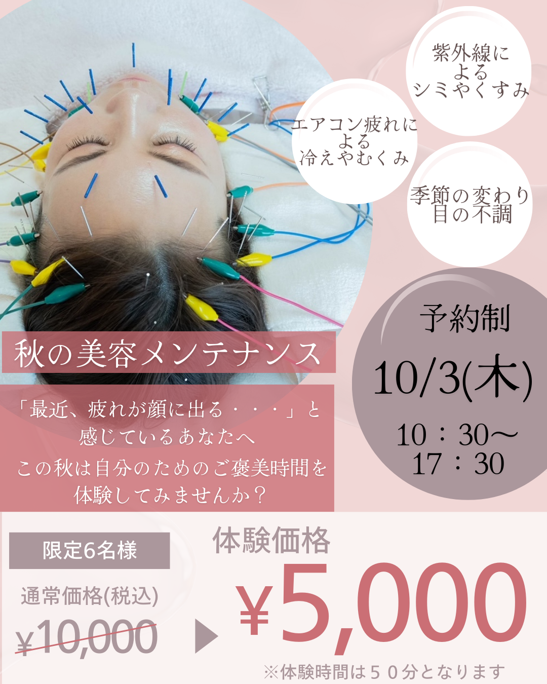 🏠モデルハウスコラボ「リフレッシュ美容鍼」🏠 | 栄和興産株式会社ー