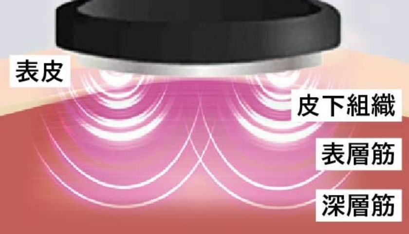 HAKEI（ハケイ）」あなたの毎日に合わせて進化するAI美顔器｜YA-MAN