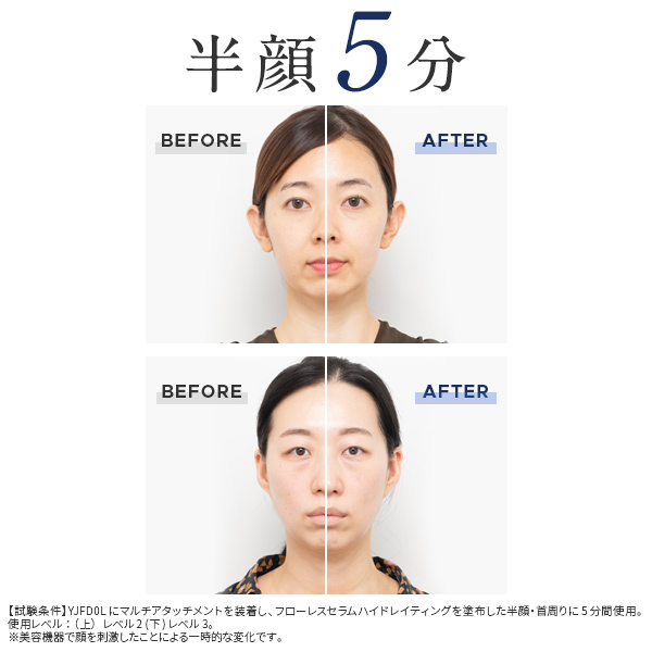 ハイパーフェイスリフトブラシ｜ヤーマン公式通販サイト | ヤーマン