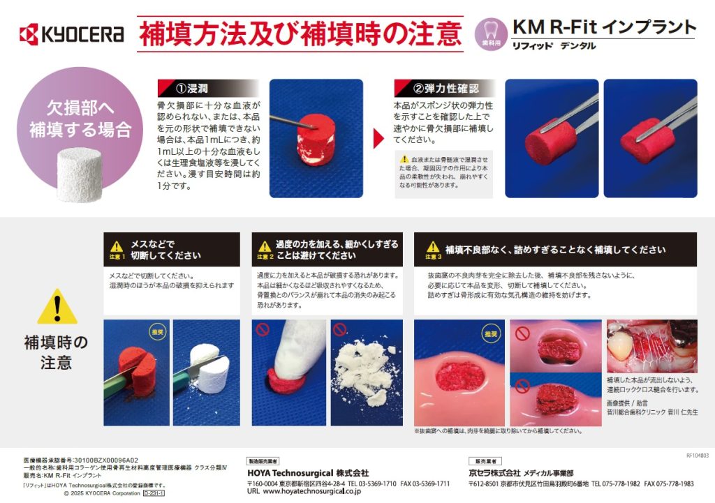 京セラ KM R-Fit インプラント リフィット デンタル ｜ ヨシダタロウ