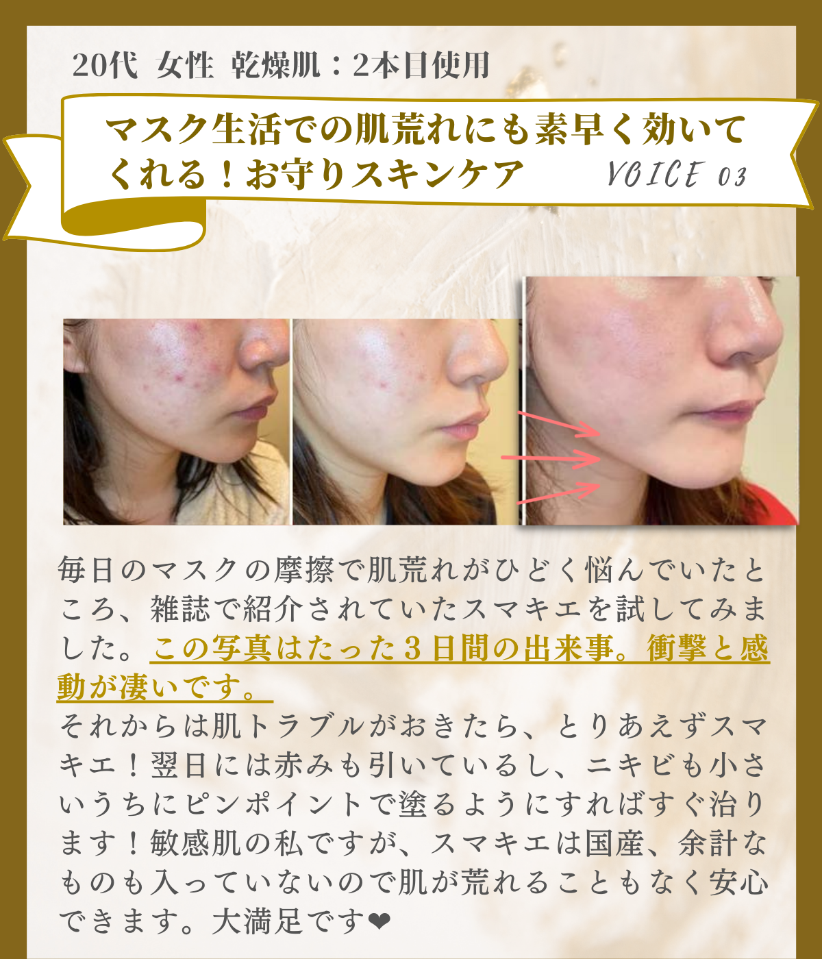 SUMAKIE スマキエセラム【公式】ヒト臍帯血美容液 | [ZELE PLUS