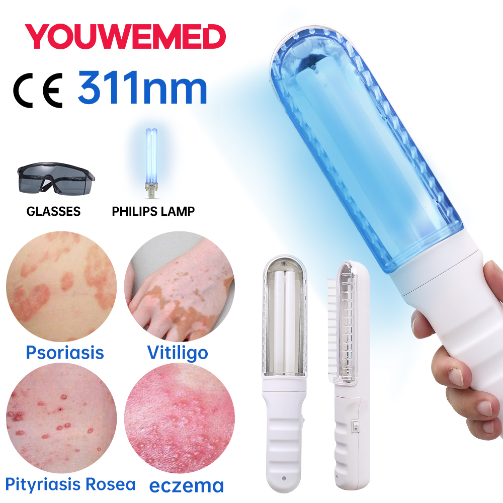 YOUWEMD Narrow Band UVB Light Therapy 311nm UVB Phototherapy