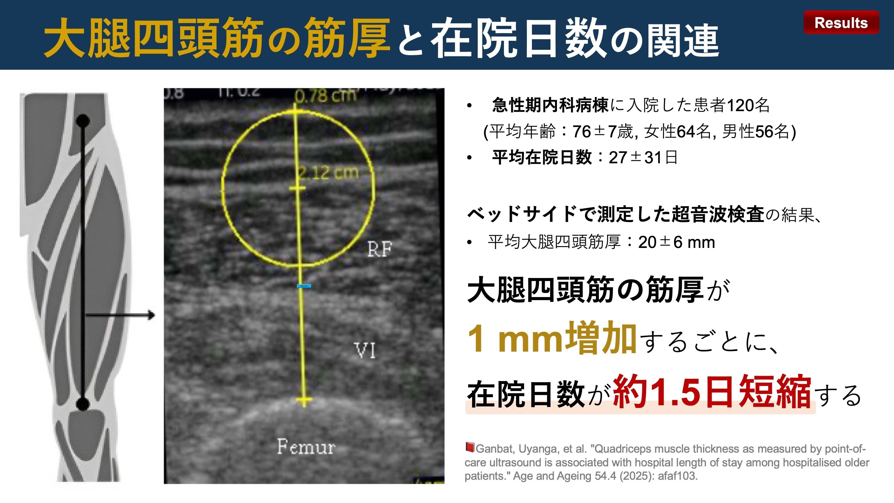 大腿四頭筋の筋厚と在院日数の関連｜Super Human | 理学療法士／保健学