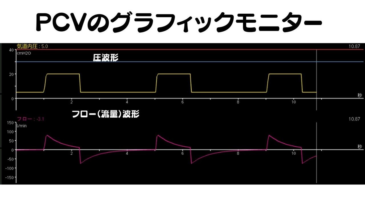 わかるまでずっと解説する人工呼吸器「そもそも非同調とはなにか