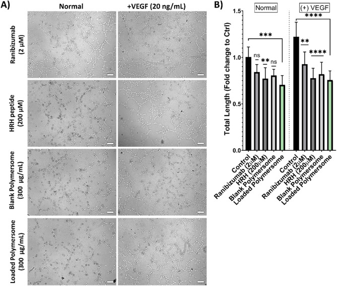 Designing blend polymersomes co-loaded with HRH peptide and