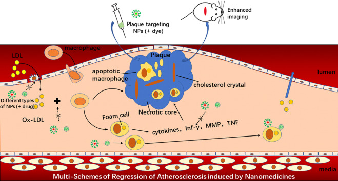 New insights to atherosclerosis management: Role of nanomaterials